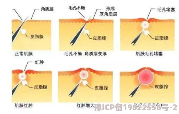 臂瓣红肿巴掌writeas手术顺利完成红肿消退开始进行康复训练